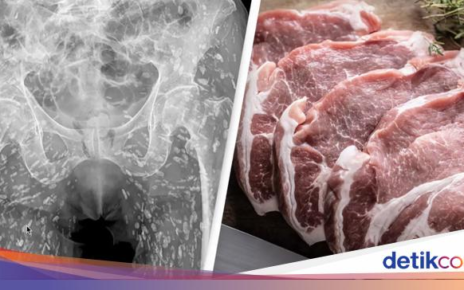 Dokter Ini Ungkap Kondisi Tubuh Orang yang Doyan Daging Babi Mentah