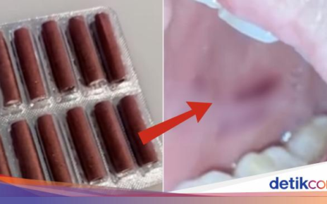 Dikira Permen, Wanita Ini Lahap Petasan dan Meledak di Mulutnya!