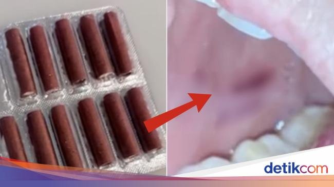 Dikira Permen, Wanita Ini Lahap Petasan dan Meledak di Mulutnya!