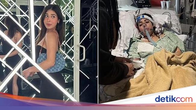 Duh! Gegara Konsumsi Minuman Energi, Wanita Ini Alami Gagal Organ
