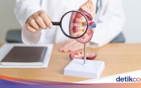 Batasi Konsumsi 5 Makanan Ini Agar Ginjal Tetap Sehat