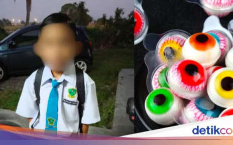 Tersedak Permen 'Bola Mata', Bocah Ini Dilarikan ke ICU
