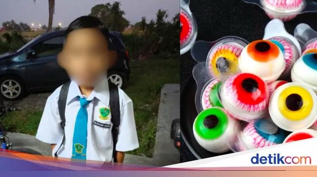 Tersedak Permen 'Bola Mata', Bocah Ini Dilarikan ke ICU