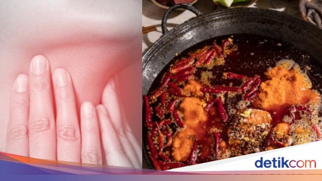 Ngeri! Wanita Ini Sakit Tenggorokan Berujung Tewas Usai Makan Hot Pot