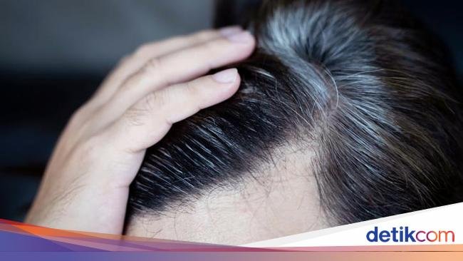 Rutin Makan Sayur Cegah Pertumbuhan Uban, Ini Kata Peneliti