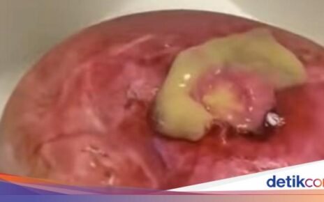 Jijik Banget! 9 Kue Viral Ini Dibentuk Mirip Toilet hingga Muntahan