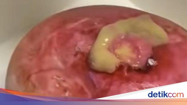Jijik Banget! 9 Kue Viral Ini Dibentuk Mirip Toilet hingga Muntahan