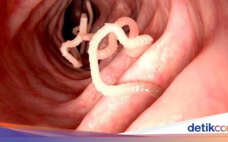 Kenali 5 Cacing dan Bakteri yang Sering 'Bersembunyi' di Makanan