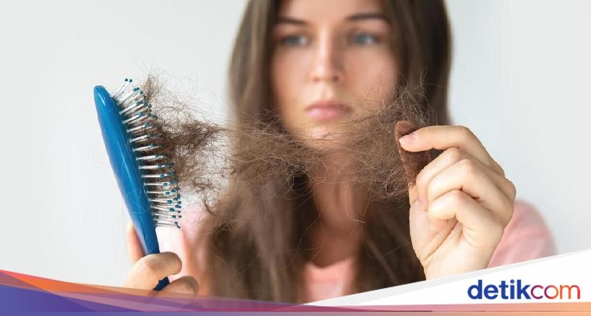 Takut Rambut Rontok? Coba Konsumsi 6 Makanan Sehat Ini