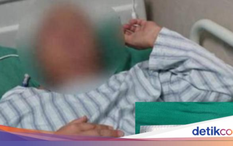 Gegara Makan Empedu Ular Mentah, Cacing Bersarang di Otak Pria Ini