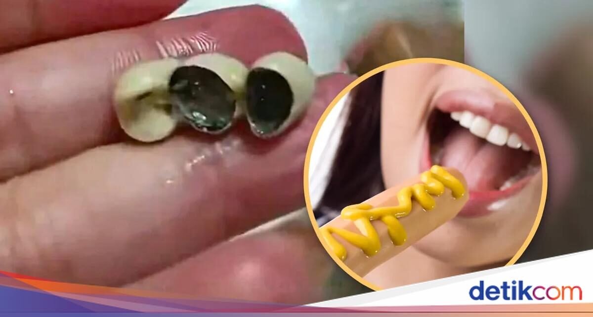 Bikin Mual! Pelanggan Temukan Gigi Manusia di Kue dan Sosis