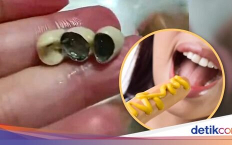 Bikin Mual! Pelanggan Temukan Gigi Manusia di Kue dan Sosis