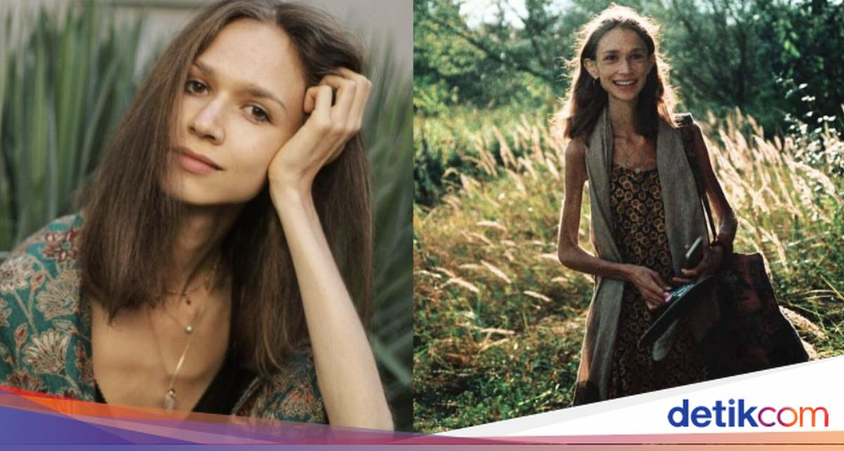 Bobotnya 27 Kg! Wanita yang Hanya Makan 1 Buah Sehari Ini Tewas