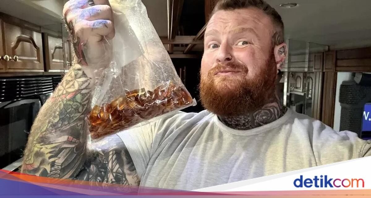 Nekat Makan Permen Gummy 3 Kg, Pria Ini Dilarikan ke Rumah Sakit