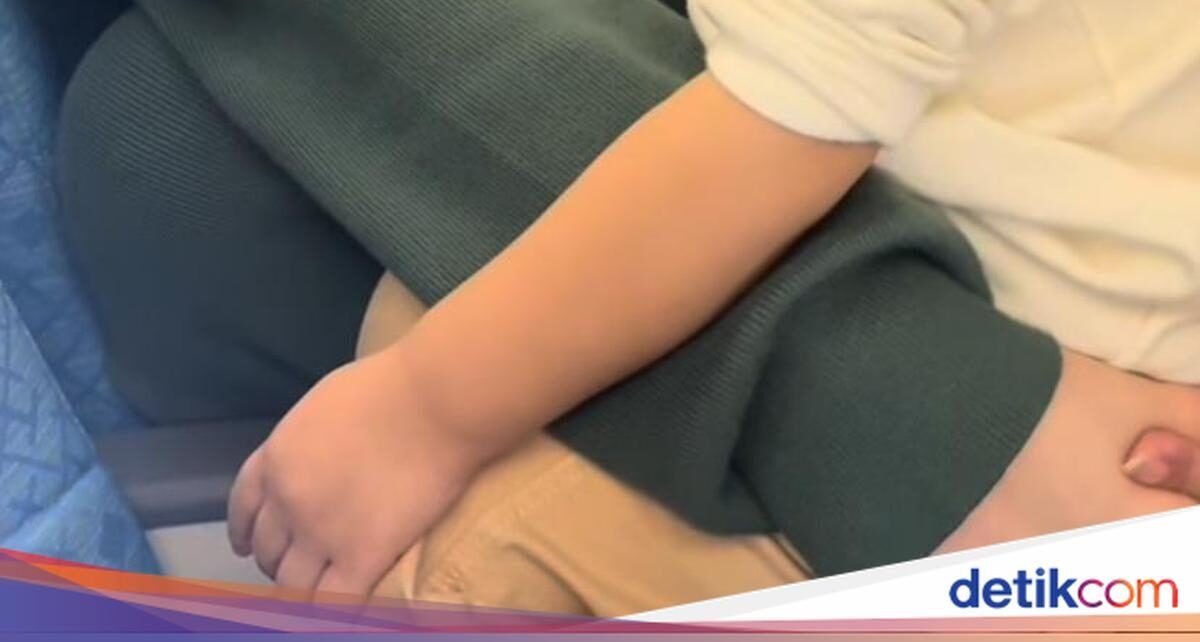 Denise Chariesta Operasi Plastik di Korea, Masih Sempat Kulineran!