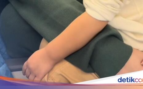 Denise Chariesta Operasi Plastik di Korea, Masih Sempat Kulineran!